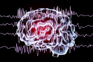 Understanding the Common Stages of a Seizure
